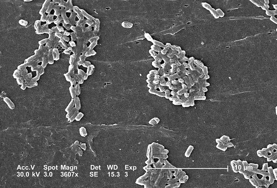 Bacteria colonial escherichia