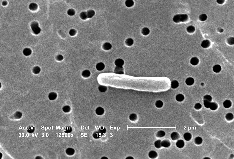 Escherichia magnification perspective