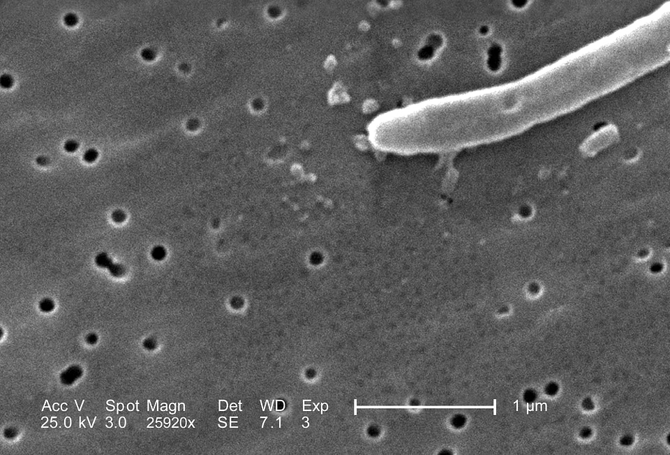 Escherichia gram negative