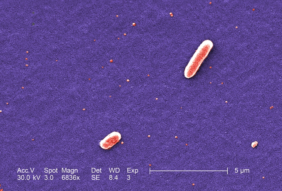 Bacteria cargo escherichia