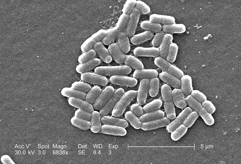 Cause disease escherichia