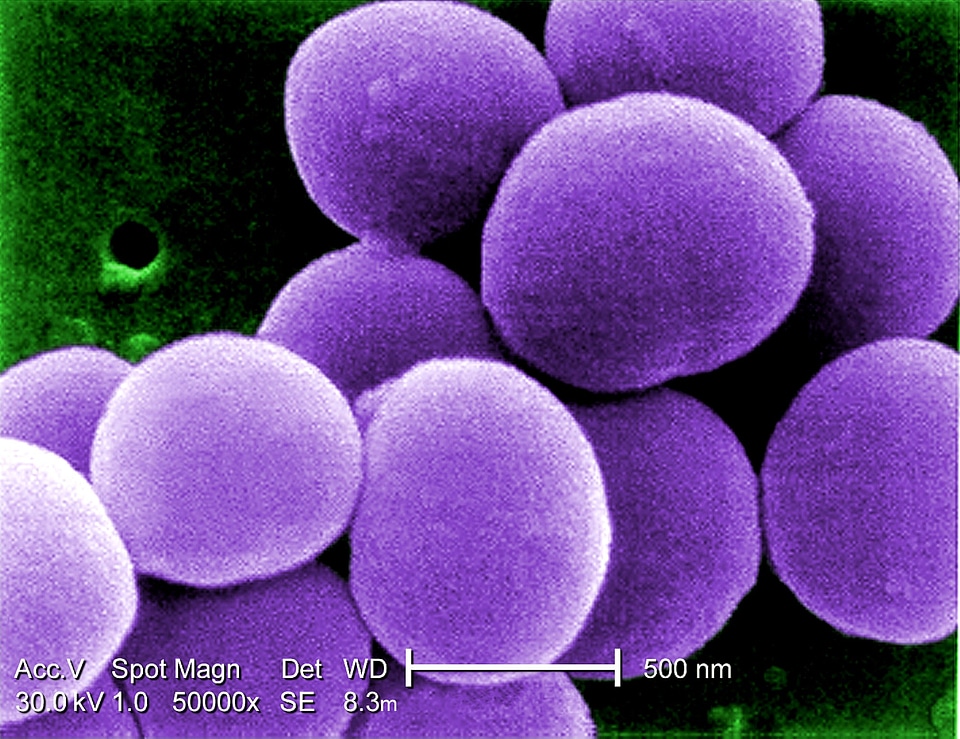 Bacteria culture effort