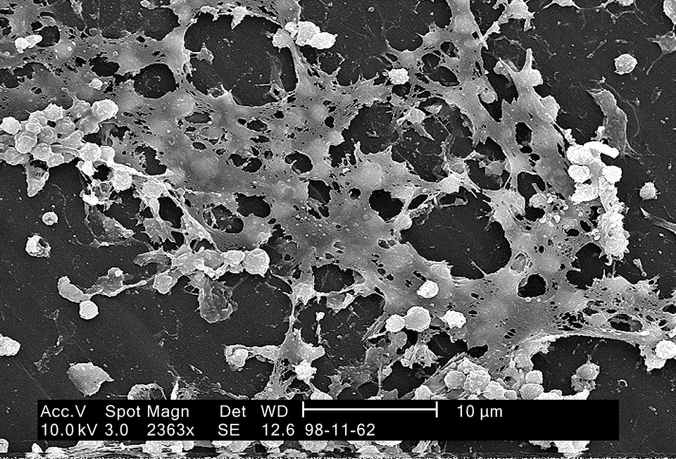 Bacteria electron electron micrograph