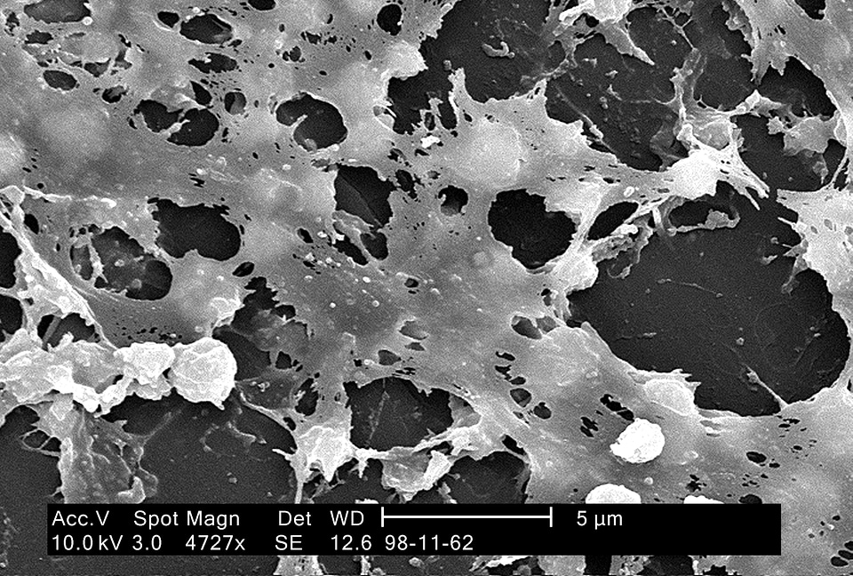 Bacteria common longer