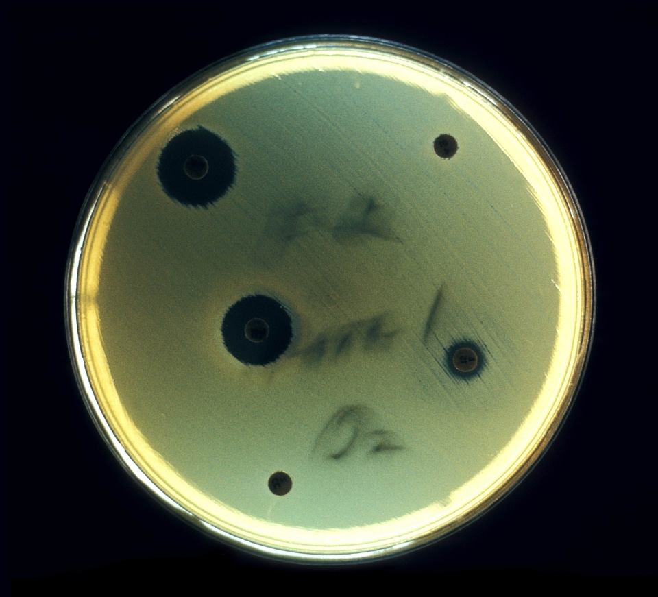 Aerobe bacteria common