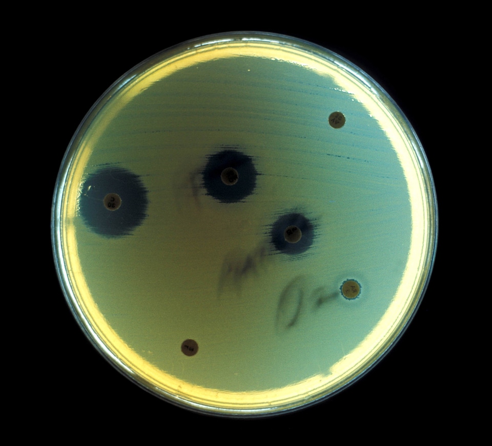 Aerobe bacteria environment