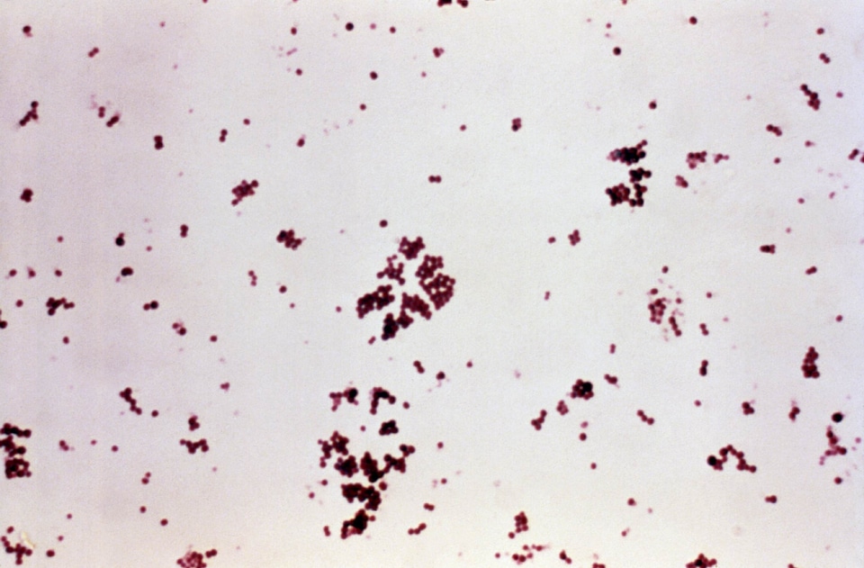 Bacteria gram shock