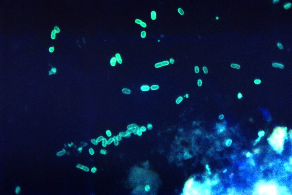 Antibody escherichia gram
