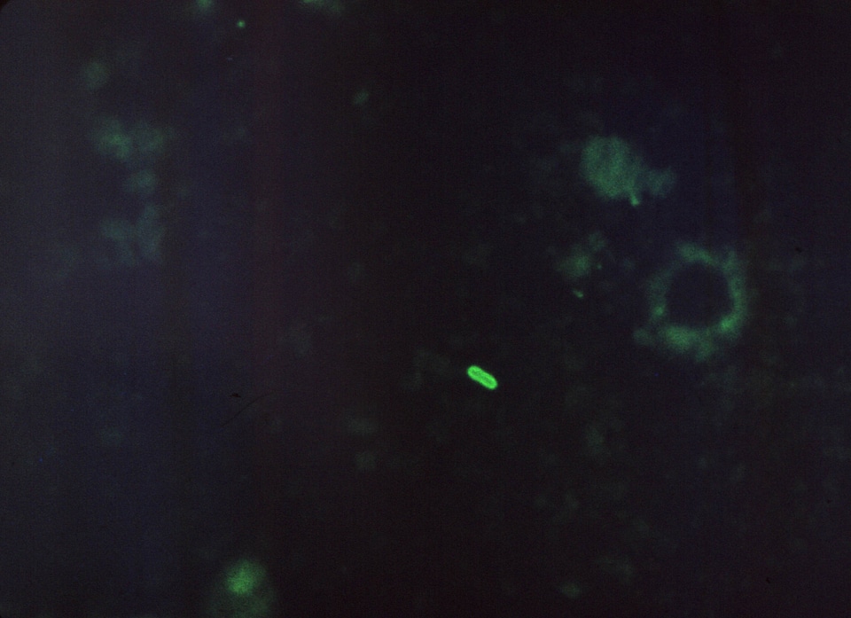 Gram negative presence