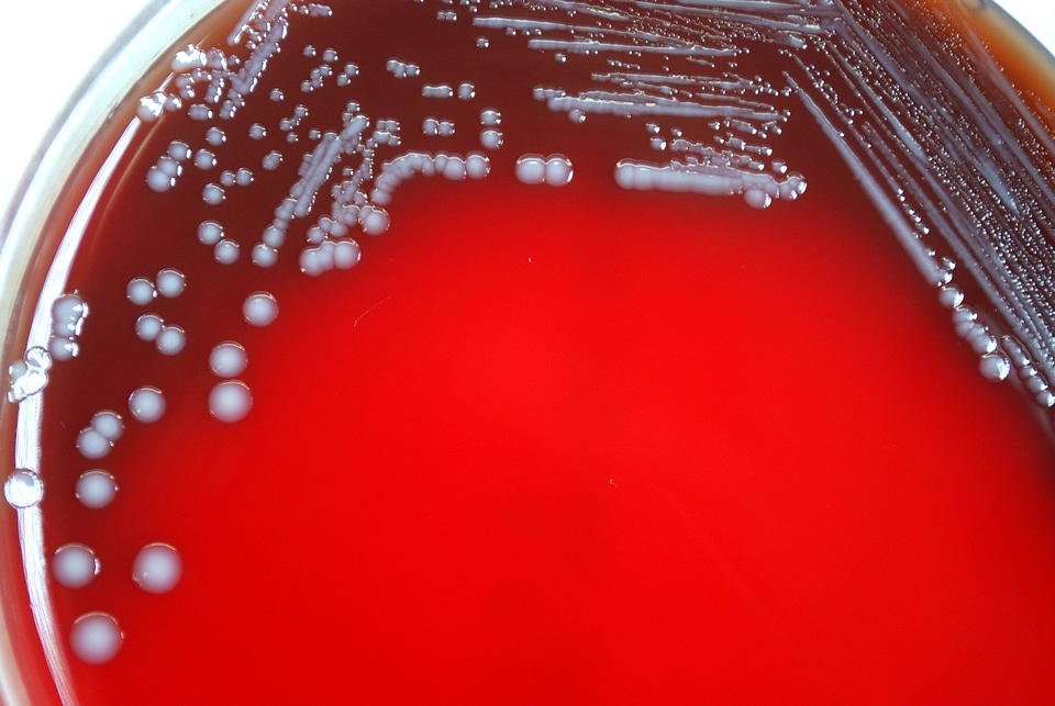 Bacteria colonial gram