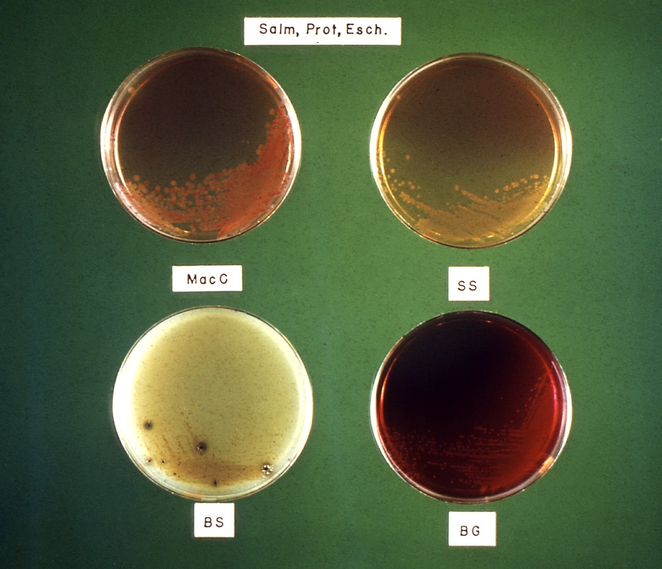 Bacteria culture media