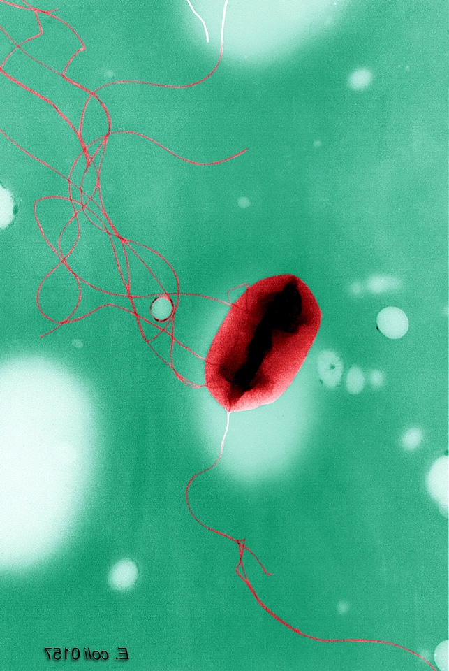 Electron electron micrograph escherichia
