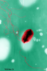 Electron electron micrograph escherichia