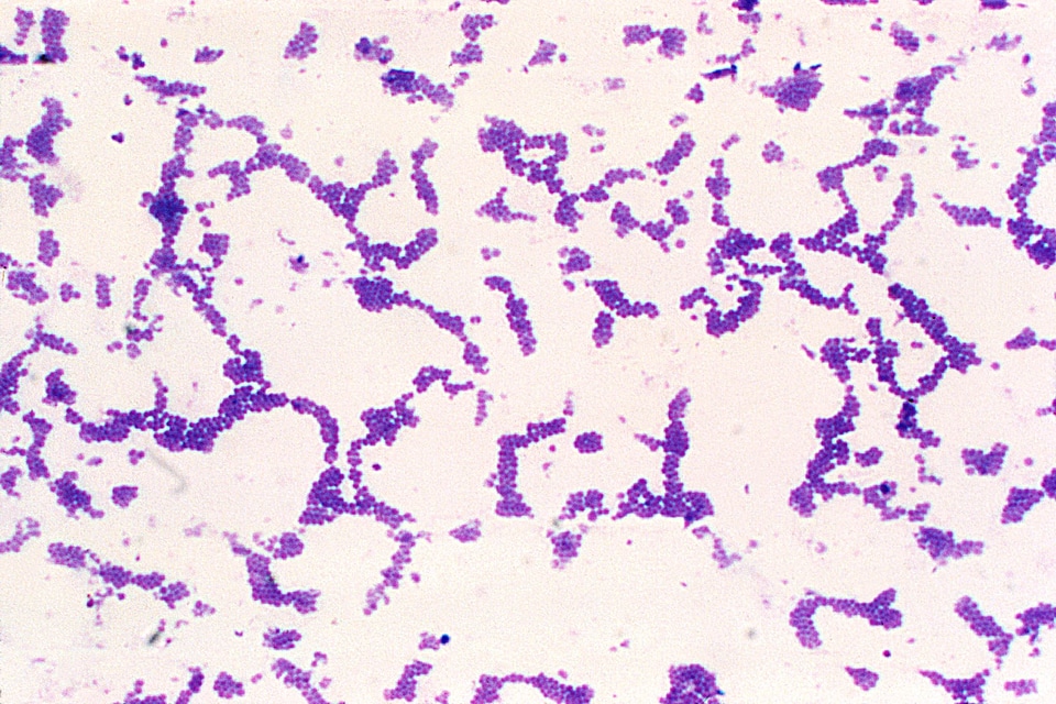 Bacteria gram photomicrograph photo