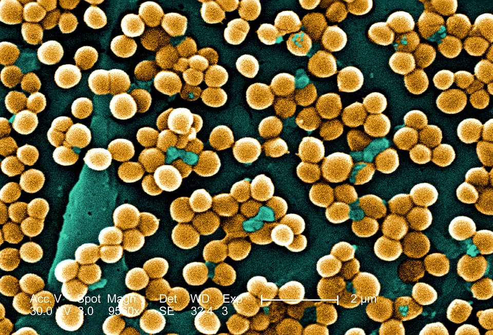 Bacteria electron methicillin