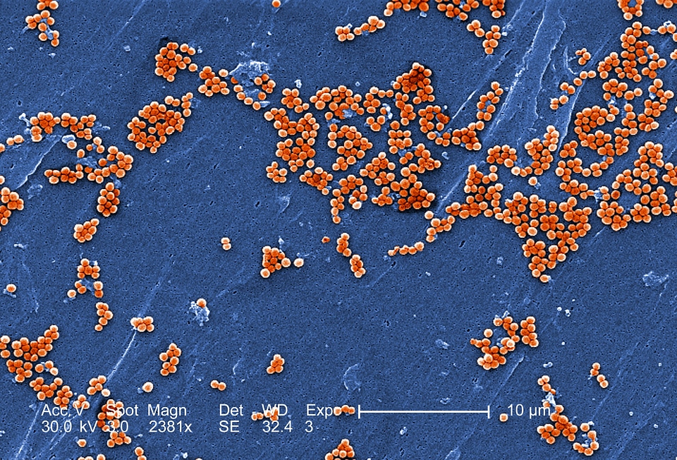 Bacteria electron electron micrograph