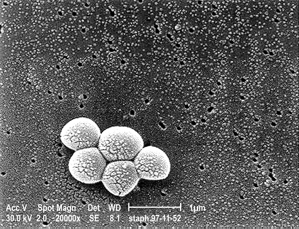 Bacteria grouping methicillin