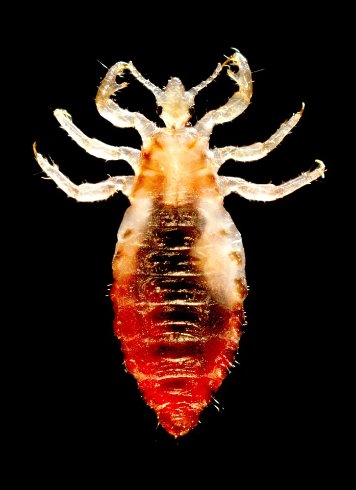 Body louse male