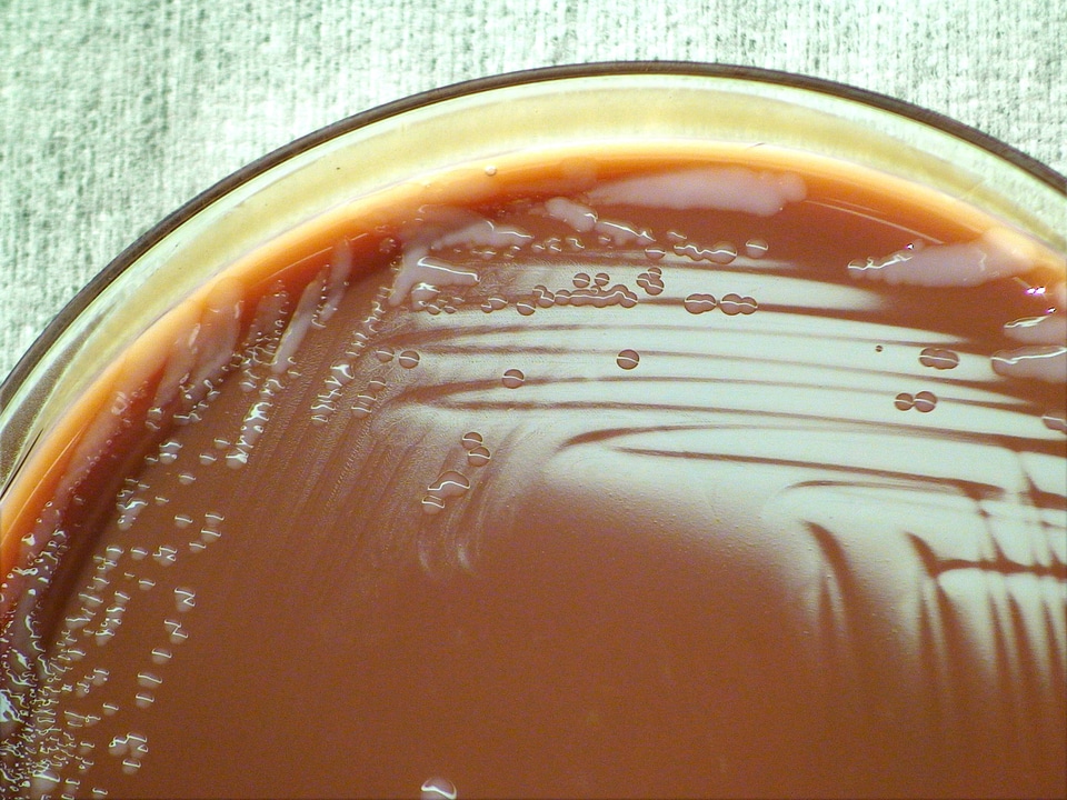 Bacteria chocolate means