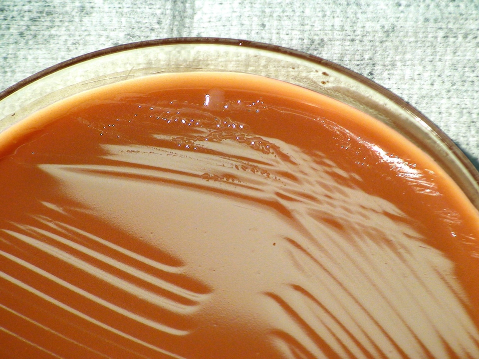Bacteria chocolate gram