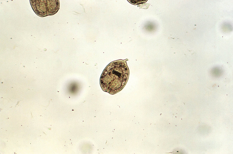 Echinococcus magnification photomicrograph photo