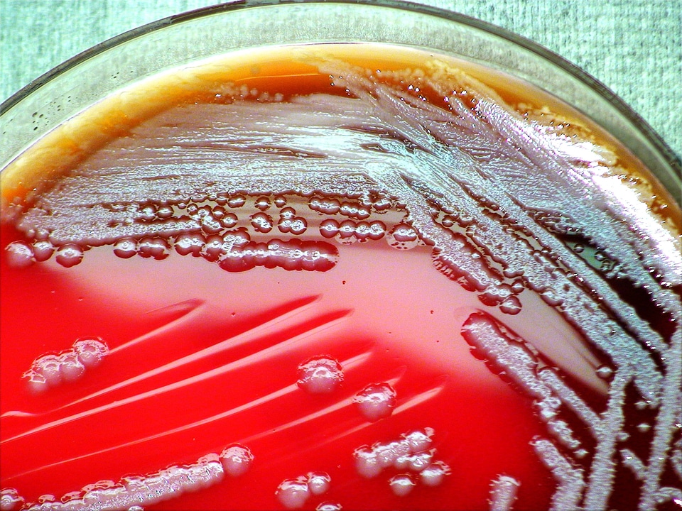 Bacteria blood blood agar