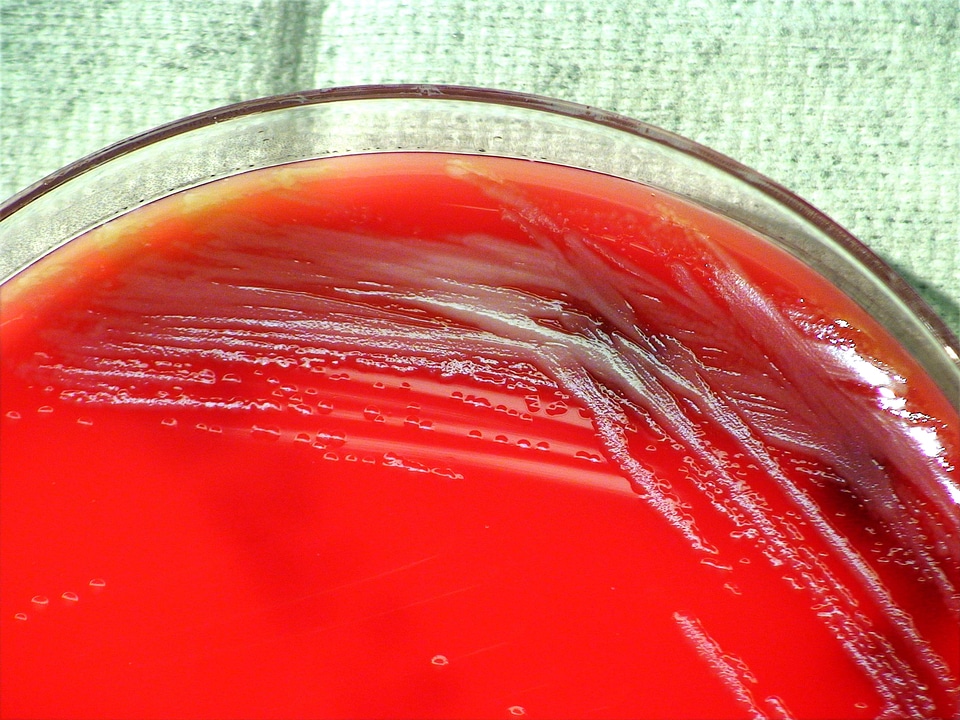 Bacteria gram morphology