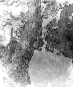 Antibody detection disease photo