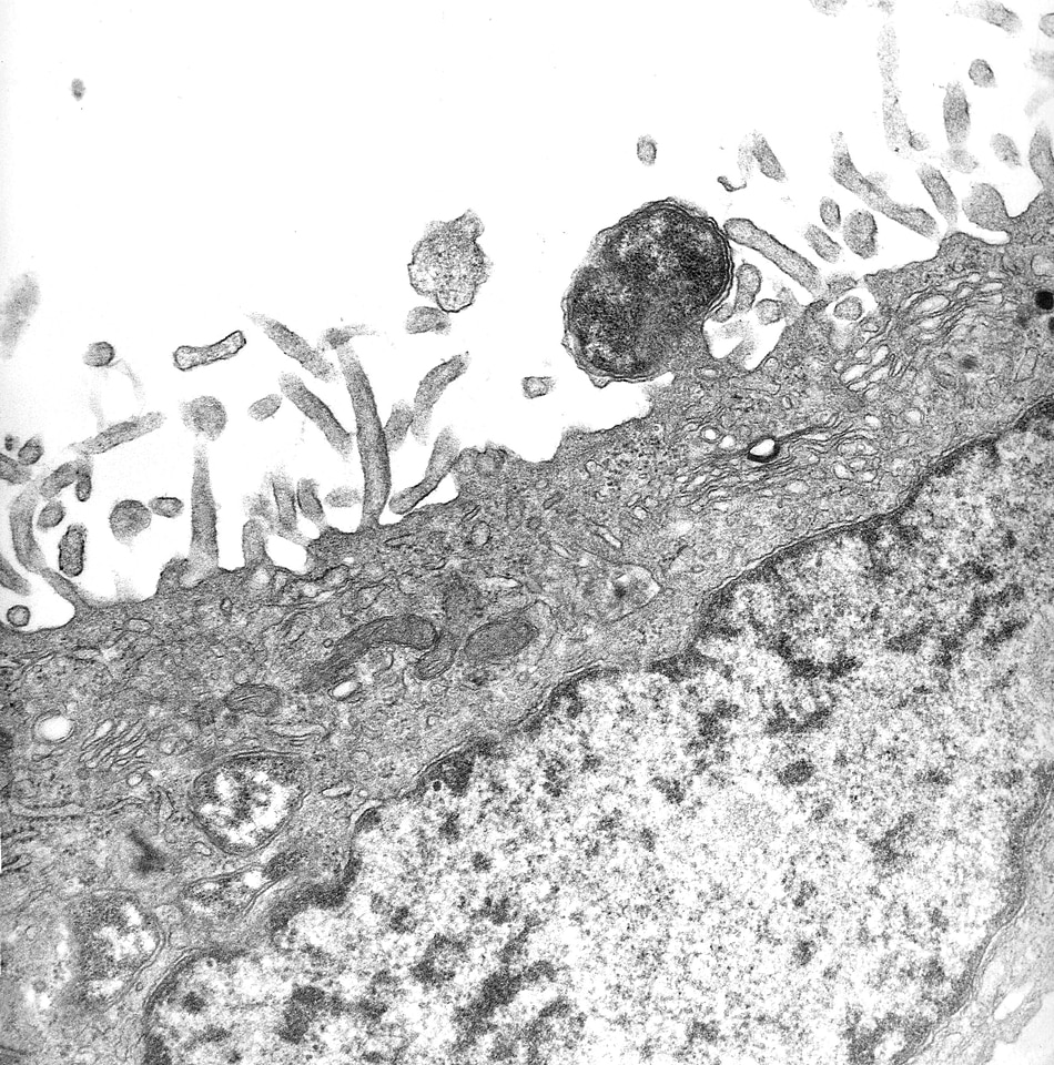 Bite larva Orientia tsutsugamushi