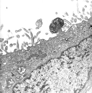 Bite larva Orientia tsutsugamushi