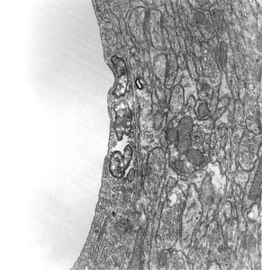 Causal Agent larva Orientia tsutsugamushi