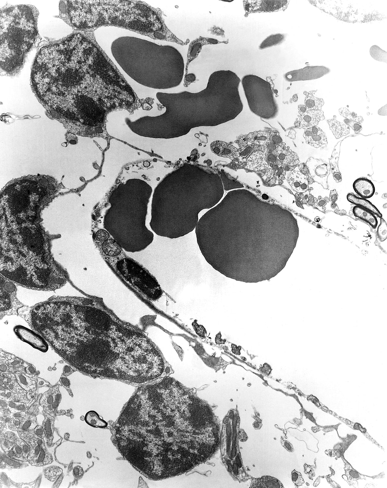 Disease japan region