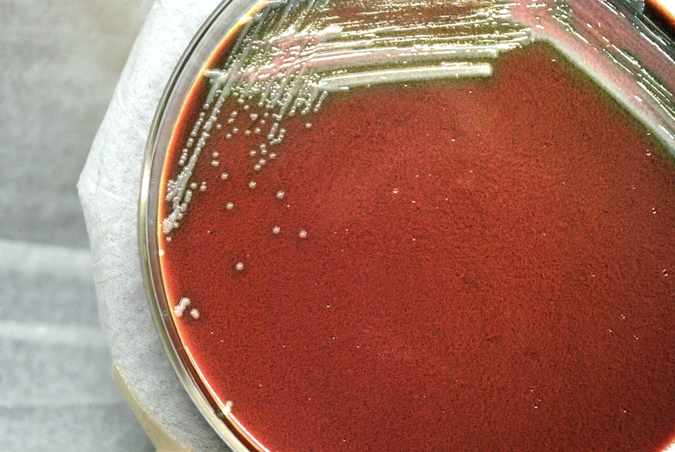 Bacteria blood colonial
