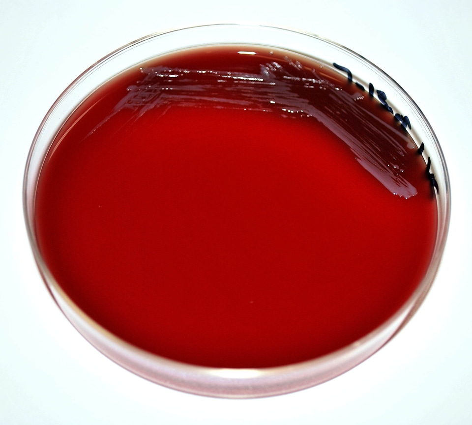 Bacteria cargo vaccine