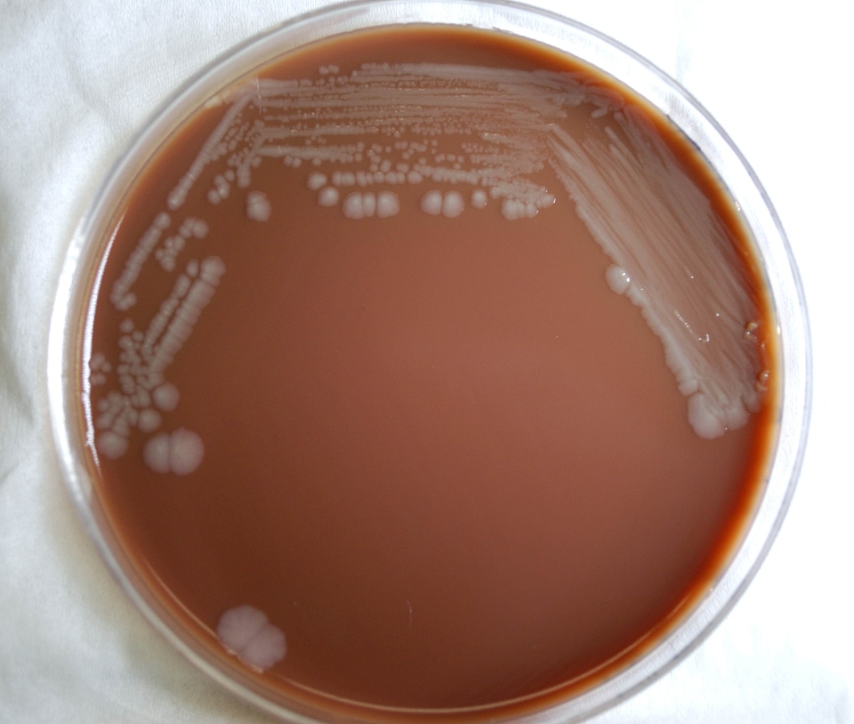Infection  