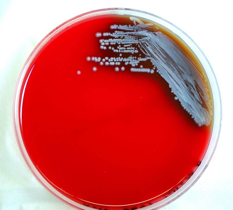 Disease infectious disease 