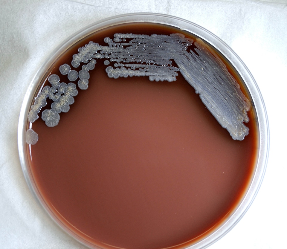 Bacteria gram negative