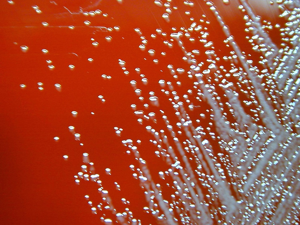 Aerobe bacteria negative