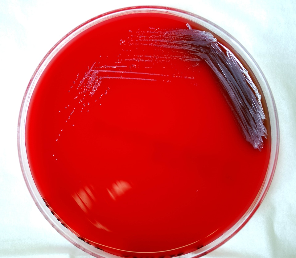 Bacteria bottom contact