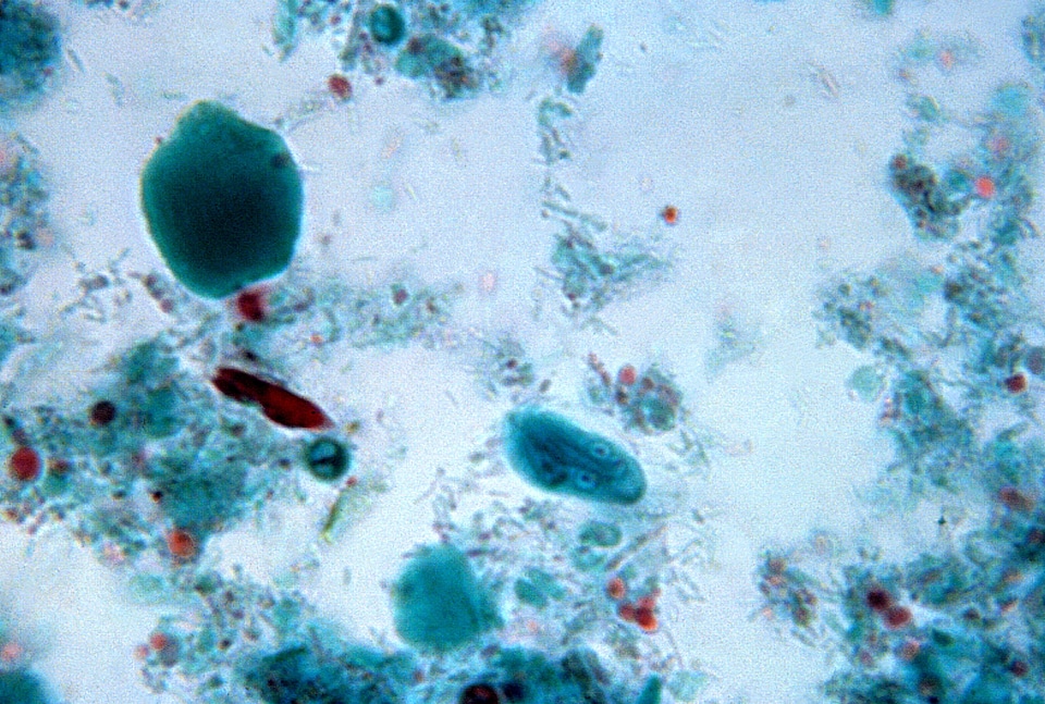 Cyst giardia photomicrograph