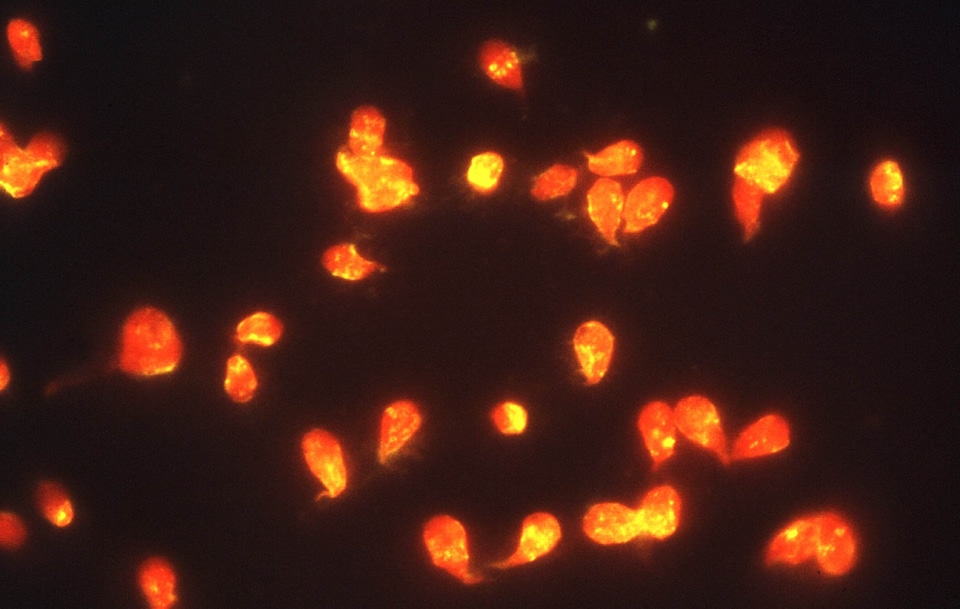 Giardia organism photomicrograph