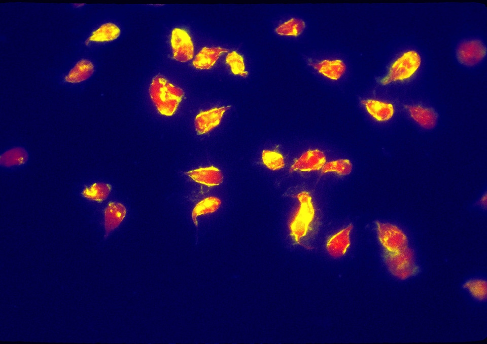 Evidence giardia immunofluorescence