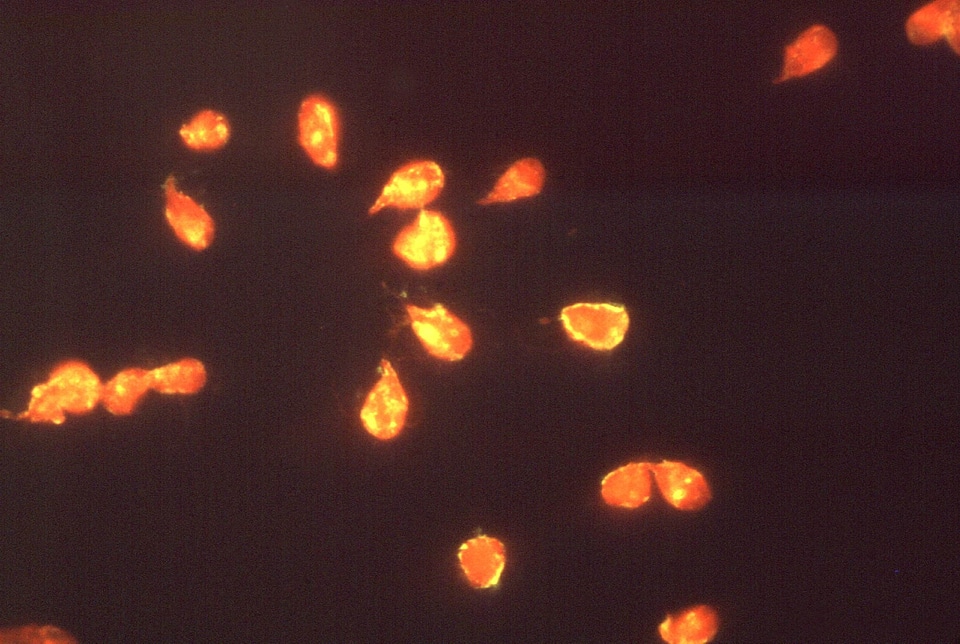 Giardia giardiasis immunofluorescence