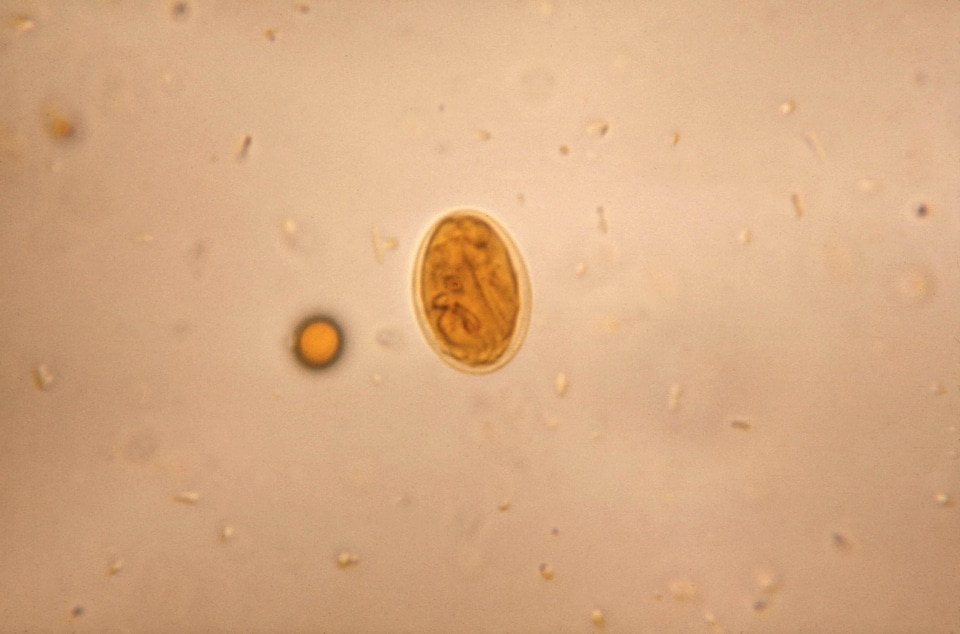 Coloration cyst giardia