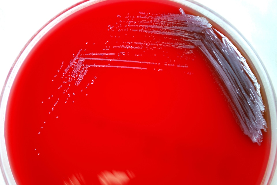 Bacteria blood blood agar