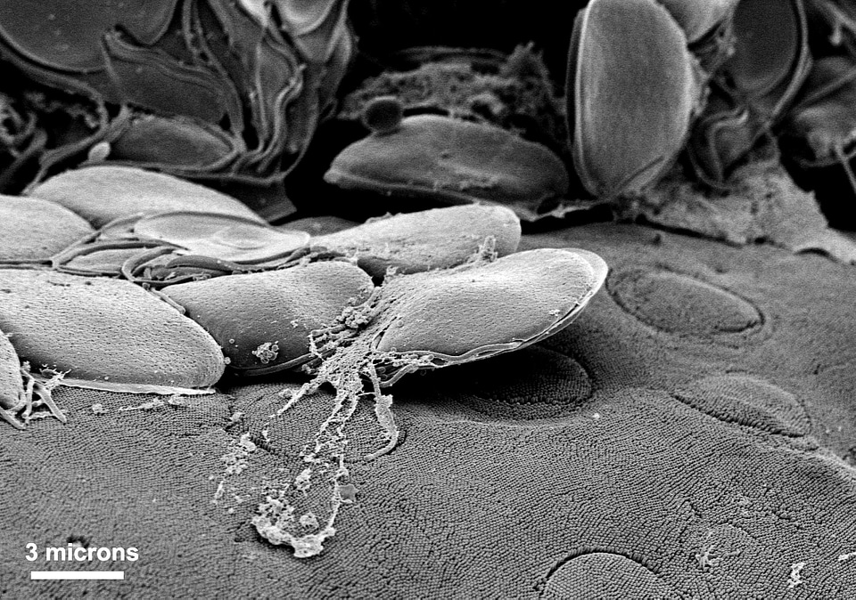 Giardia group surface