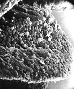 Giardia villus 