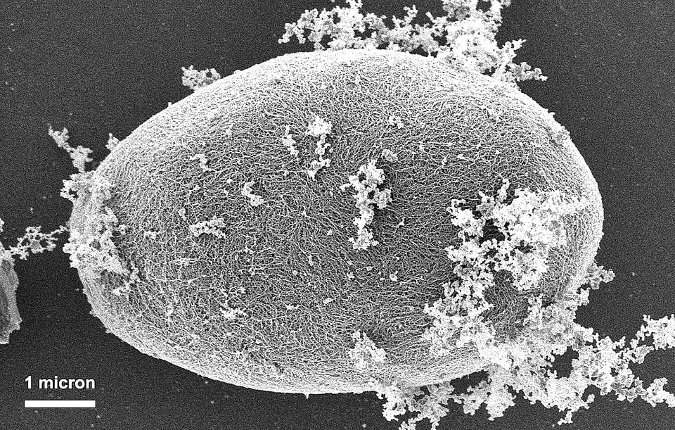Disease giardia giardiasis
