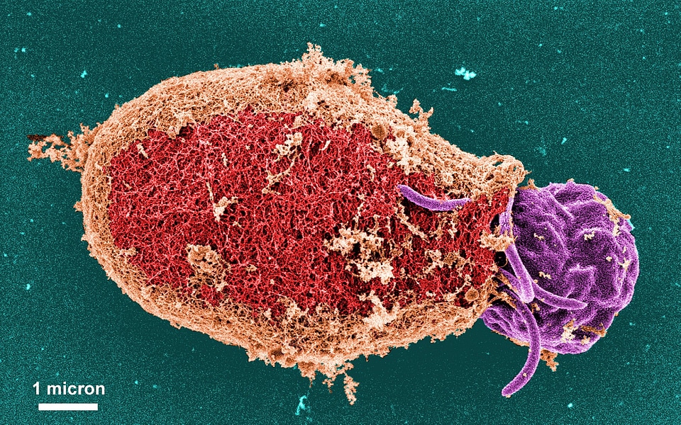 Cyst details giardia