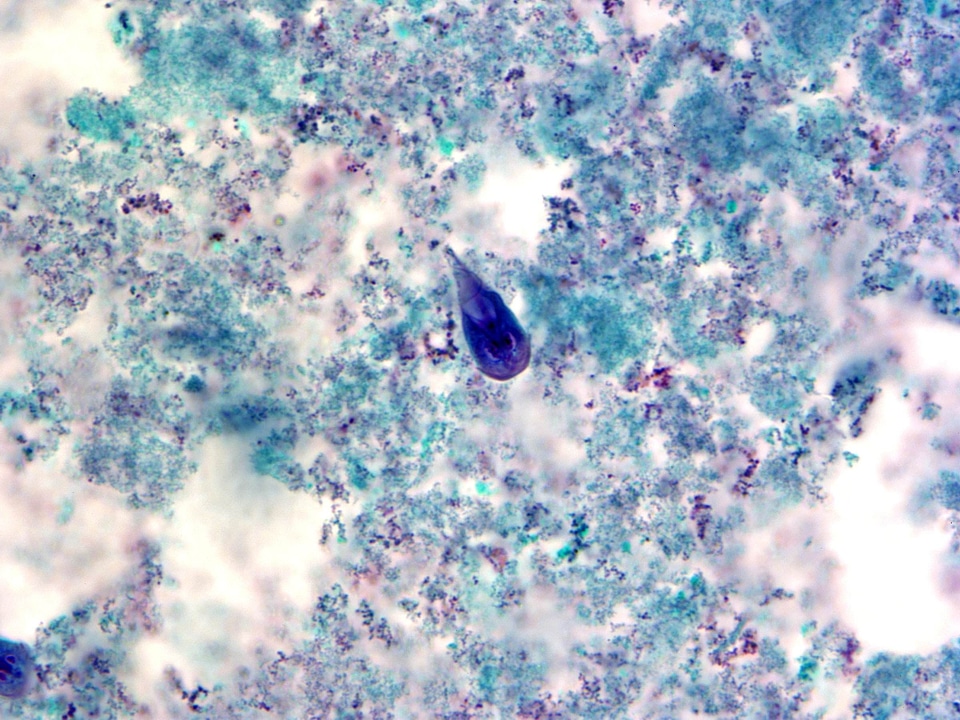 Blue giardia morphologic